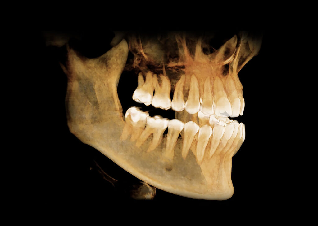 prikaz anatomskih struktura na 3d ortopanu